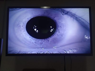 Consulta Médica Neuro Otológica